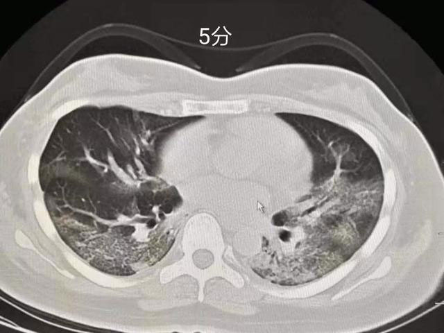 ˫Ĥ෢Ƭ״ĥܶӰ߽ɶڣڣݱΪƬʵաά2