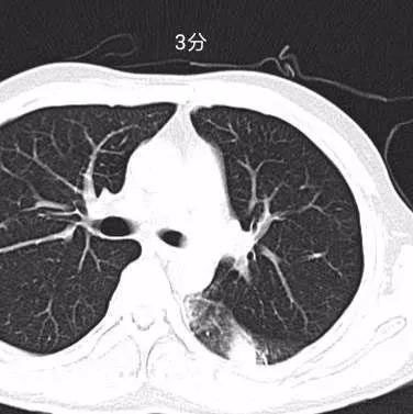 ޵Ҷβ䣬ҶСƬӰ෢СڣʾβȾԲ