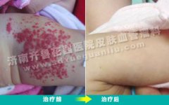 �����첲������һƬ��С�����ô�κõĿ�