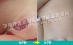 Ӳϵɫ׿Ϊʲôһ޾ͱ