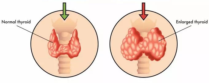 ͼΪļ״٣ͼΪ״ļ״