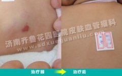 ΪʲôϹĺ̥Ǵ򼤹ûЧ