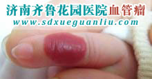有什么药可以治血管瘤 13W5910D20620-160a_lit.jpg