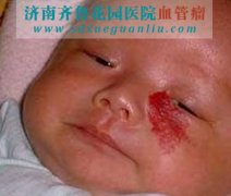 沿ݮ״Ѫƺûа̺ ָܻɫ